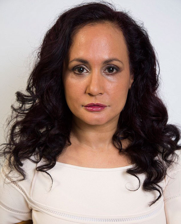 Kırışmamak için yıllardır gülmüyor - Resim: 2