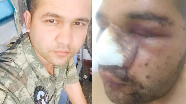 DEAŞ'ın vurduğu tankın içindeki Türk askeri Facebook'a yazdı - Resim: 1