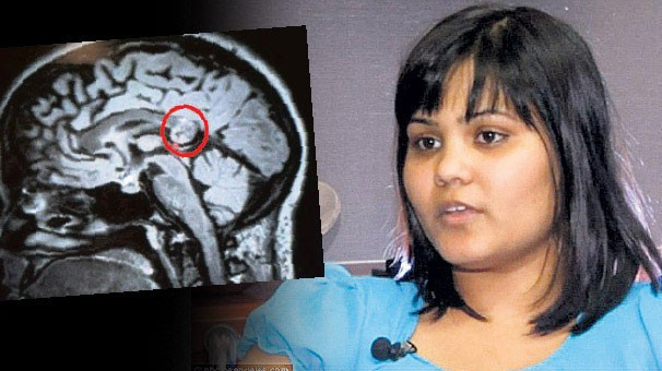 Beyninden kardeşi çıktı! Tıp dünyası şokta - Resim: 3