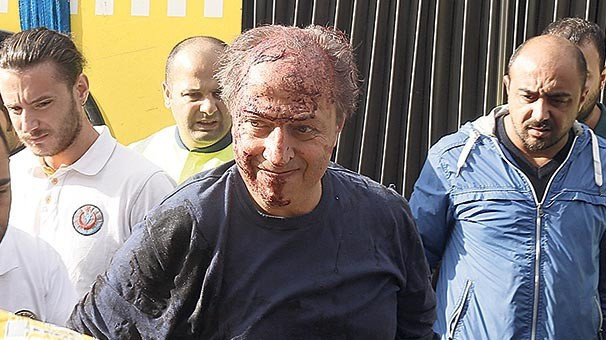 Metrobüsün altından sağ çıktı! Mucizeyi böyle anlattı - Resim: 3