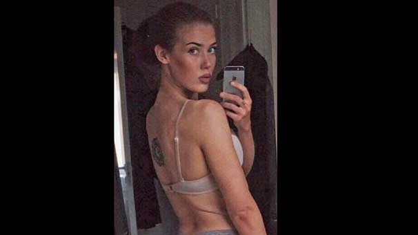 Çay kaşığı ile beslenip  60 kilo verdi - Resim: 1