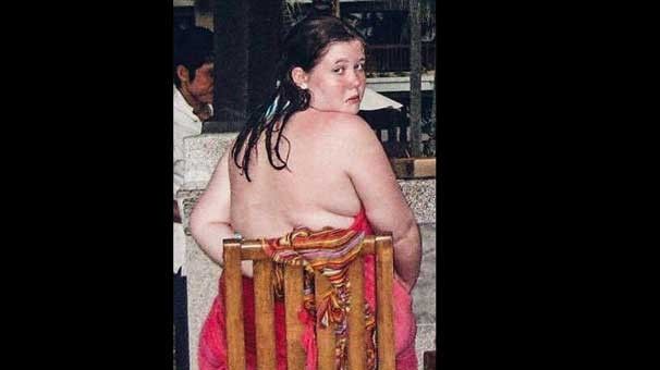 Çay kaşığı ile beslenip  60 kilo verdi - Resim: 2