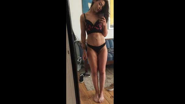 Çay kaşığı ile beslenip  60 kilo verdi - Resim: 4