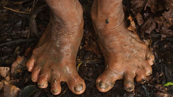 Film sahnesi değil tamamen gerçek! Bu ayakların sahibi... - Resim: 4