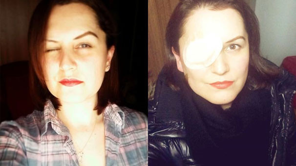 ‘Evlenme imkanım azaldı’ deyip 150 bin TL istedi! - Resim: 1