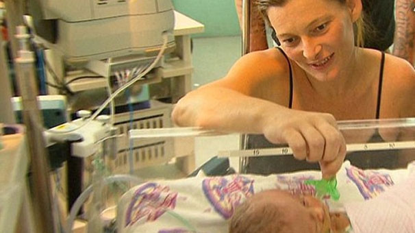 Onlar 'iki yüzlü' olarak dünyaya geldi inanması zor ama gerçek! - Resim: 1