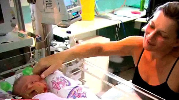 Onlar 'iki yüzlü' olarak dünyaya geldi inanması zor ama gerçek! - Resim: 3