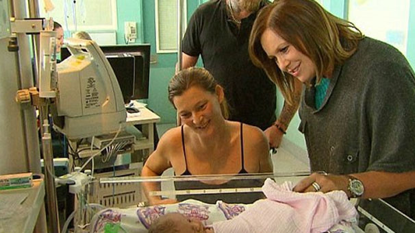 Onlar 'iki yüzlü' olarak dünyaya geldi inanması zor ama gerçek! - Resim: 4