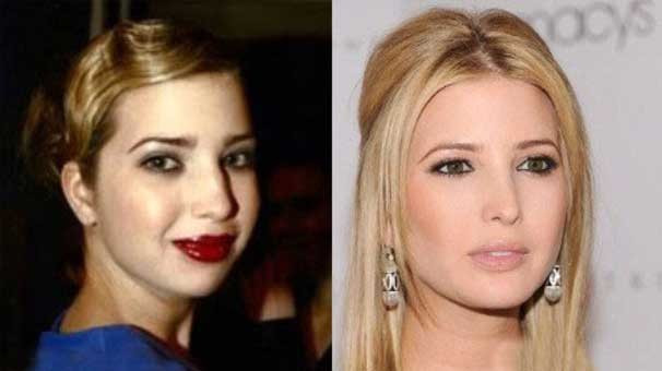 Ivanka Trump'ın estetiksiz hali çok şaşırttı! İşte o görüntüler... - Resim: 3
