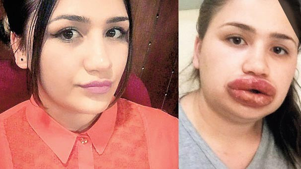 Silikon yaptırmak istemişti hemşire Merve Keleş ilk kez konuştu - Resim: 4