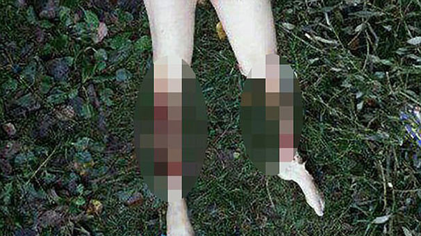 Baldırı ve göğsünü kesip ormana attılar burada kimse sokağa çıkamıyor - Resim: 2