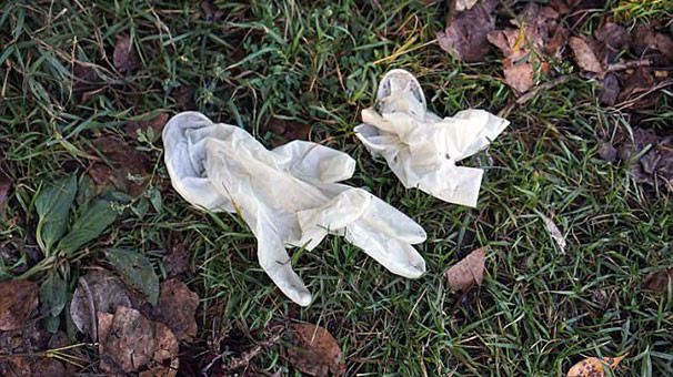 Baldırı ve göğsünü kesip ormana attılar burada kimse sokağa çıkamıyor - Resim: 3