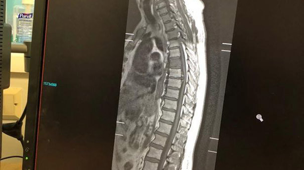 70 yaşındaki adamın içinden köpek çıktı! - Resim: 2