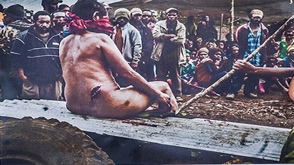 Kadınları canlı canlı yakıyorlar - Resim: 1