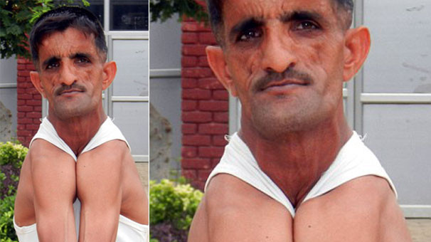 Dünyanın en garip adamı - Resim: 1