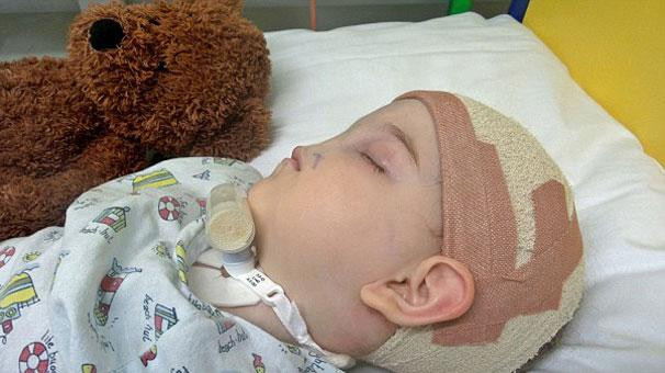 Burnu olmadan doğan bebek - Resim: 3