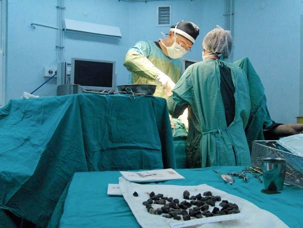 Midesinden sesler gelince doktorlar gözlerine inanamadı - Resim: 4