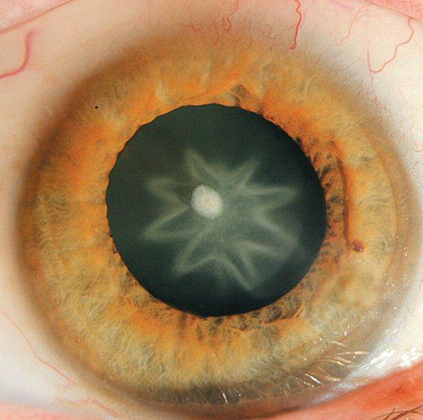 Bu karelerde bir tuhaflık var! - Resim: 2