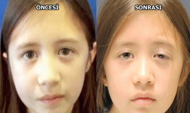 Öyle bir rahatsızlığı var ki! Tedavisi bulunamıyor  - Resim: 1