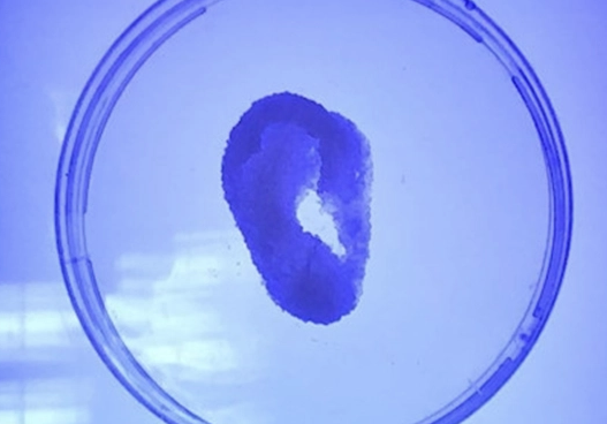 3 boyutlu yazıcıdan yapay kulak üretildi - Resim: 0