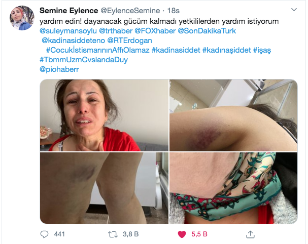 Eski eşinin kaçırıp dövdüğü kadının çığlığı! Beni kurtarın artık dayanamıyorum - Resim: 2