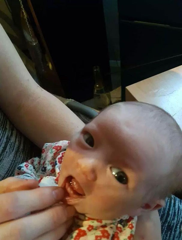 Ağzında dişleriyle doğan bebek herkesi şoke etti! - Resim: 4