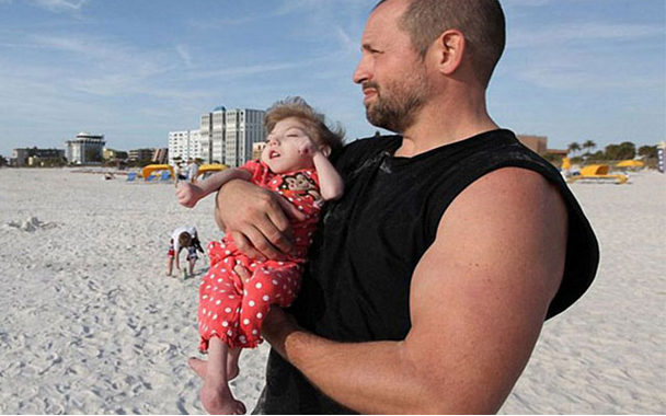 Hiç büyümeyecek çocukların tuhaf hikayesi - Resim: 2