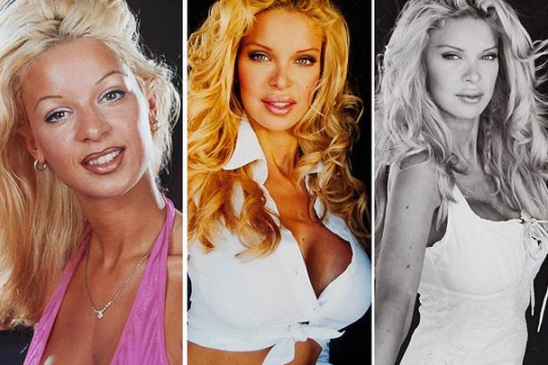 331 kez ameliyat olan mankenin hali - Resim: 4