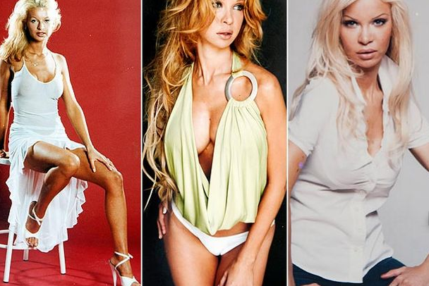 331 kez ameliyat olan mankenin hali - Resim: 3