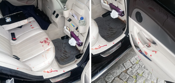 Gelecek Partisi Genel Başkan Yardımcısı Selçuk Özdağ'a silahlı saldırı düzenlendi - Resim: 2