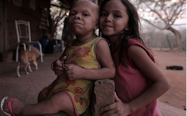 Hiç büyümeyecek çocukların tuhaf hikayesi - Resim: 1