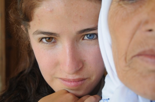 Hayata iki renk bakıyorlar - Resim: 1