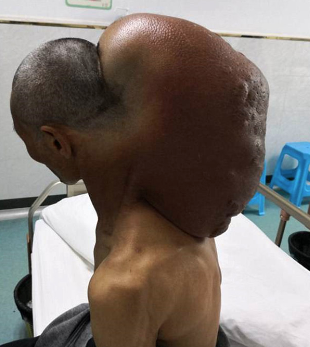 Boynunu görenler korkup kaçıyordu tam 15 kilo! - Resim: 1