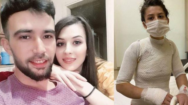 Eşi tarafından şiddet görüp, kaynar suyla yakılan kadın konuştu - Resim: 0