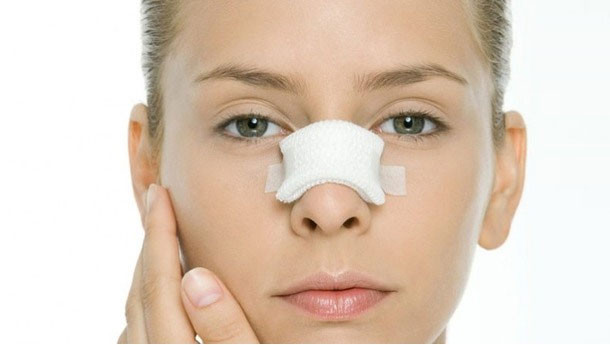 Burun estetiğinde neştersiz Türk çözümü - Resim: 3