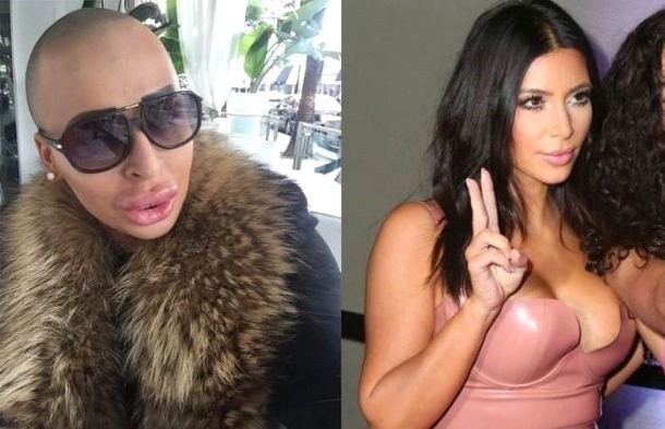 Kim Kardashian'a benzemek için servet harcadı sonuç... - Resim: 4