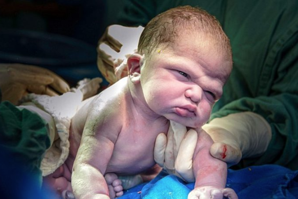 Birbirinden garip doğum anı fotoğraflarına çok şaşıracaksınız - Resim: 2