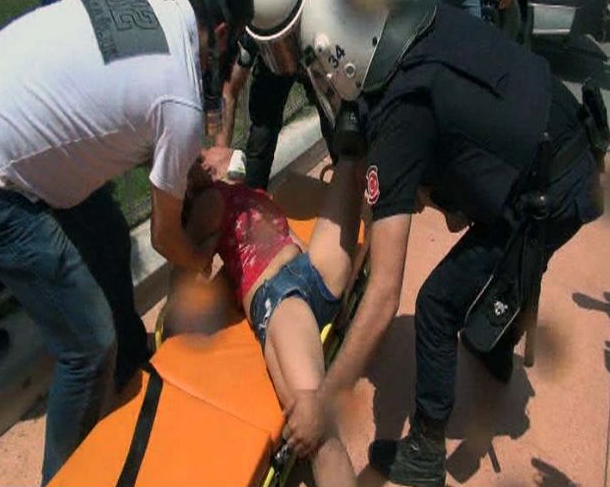 Turistin kafasını kırdılar... - Resim: 2