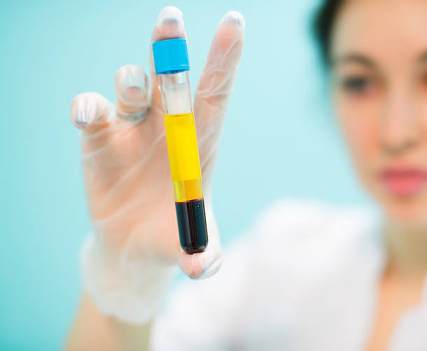 PRP tedavisi nedir? Saç, cilt ve kireçlenme için PRP kaç seans yapılır - Resim: 0