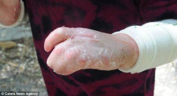 Bu kızın hastalığı içinizi acıtacak - Resim: 3