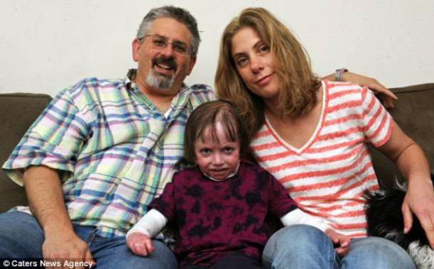 Bu kızın hastalığı içinizi acıtacak - Resim: 2