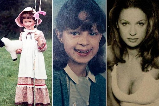 331 kez ameliyat olan mankenin hali - Resim: 1