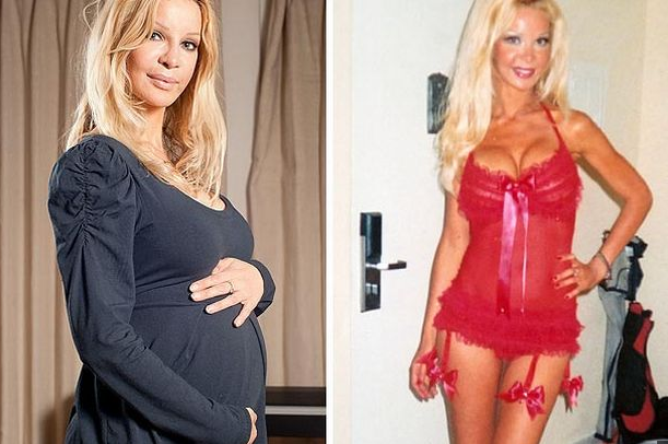 331 kez ameliyat olan mankenin hali - Resim: 2