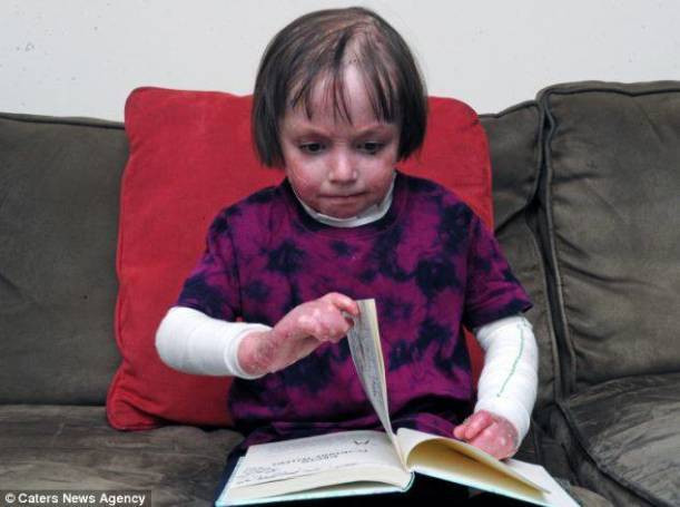 Bu kızın hastalığı içinizi acıtacak - Resim: 4