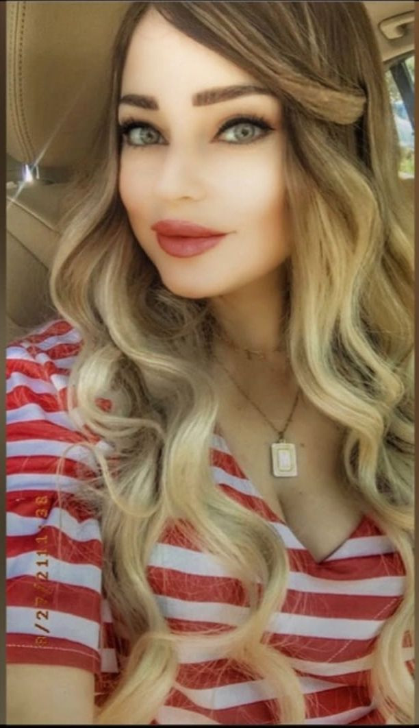 Antalya'da sitede köpek besleme kavgası! Başaslan ailesine palalı saldırı - Resim: 2