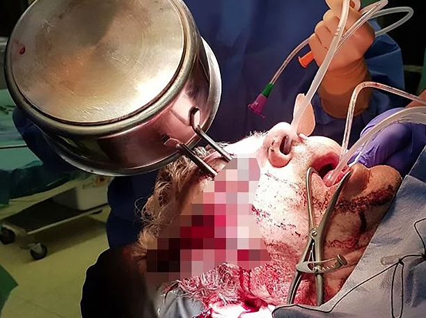 Mutfakta yere düştü gözüne tencere saplandı akıllara zarar olay! - Resim: 2