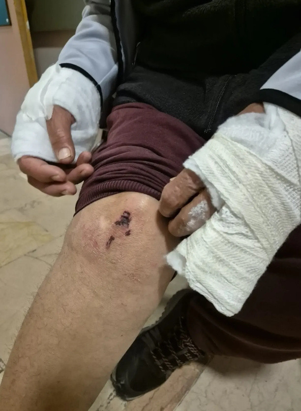 Tunceli'yi ayağa kaldıran iddia: Avukat Alişer Ölmez öz teyzesini darp etti - Resim: 2