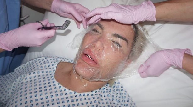 60 kez operasyon geçirdi doktorları dinlemedi! Son hali olay - Resim: 2