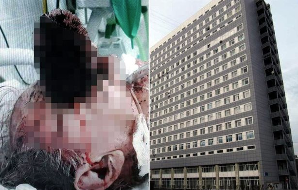 Tuvalet fırçası gözüne saplandı akıllara durgunluk veren olay! - Resim: 3