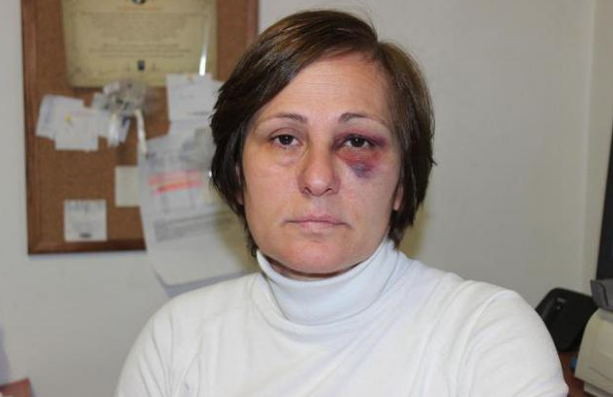 Sokak hayvanlarını besliyor diye gözünü morarttılar! - Resim: 2